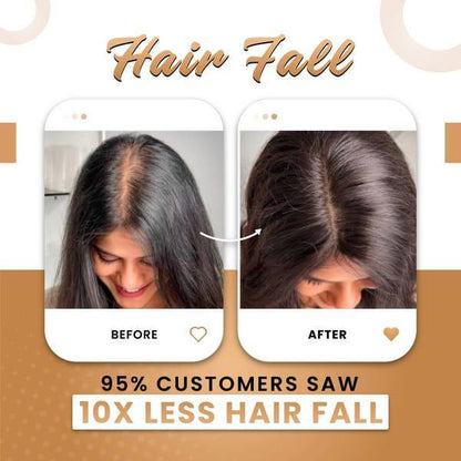 Premium Hair Oil for Hair Growth & Thickness – Anti Hair Fall Natural Oil 200ml - My Store