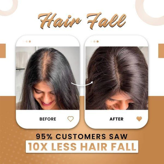 Premium Hair Oil for Hair Growth & Thickness – Anti Hair Fall Natural Oil 200ml - My Store